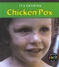 Chicken Pox (Its Catching)