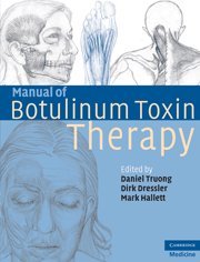 Manual of Botulinum Toxin Therapy,Used