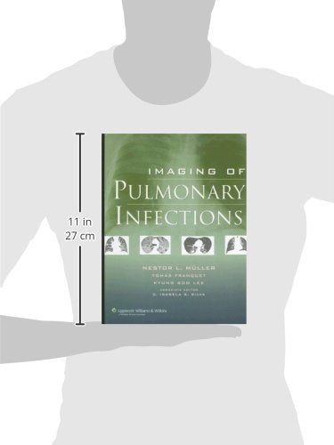 Imaging of Pulmonary Infections,Used