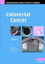Colorectal Cancer (Contemporary Issues in Cancer Imaging),Used