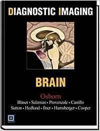 Diagnostic Imaging: Brain,Used