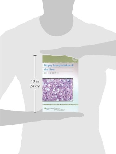 Biopsy Interpretation of the Liver,Used