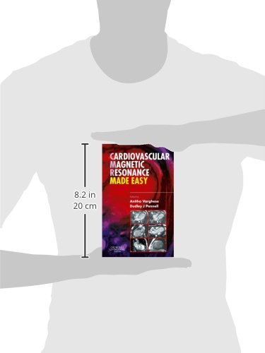 Cardiovascular Magnetic Resonance Made Easy,Used