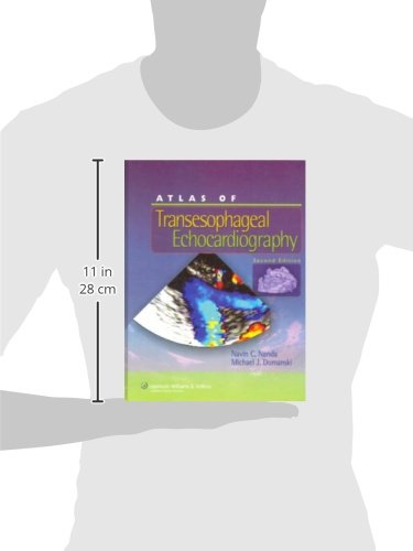 Atlas of Transesophageal Echocardiography,Used