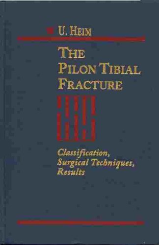 The Pilon Tibial Fracture: Classification, Surgical Techniques, Results,New