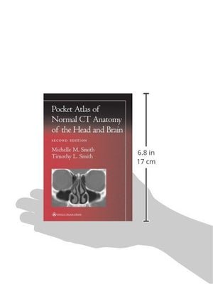 Pocket Atlas of Normal CT Anatomy of the Head and Brain (Radiology Pocket Atlas Series),Used