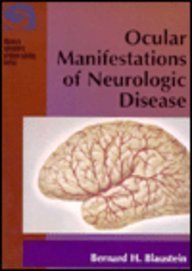 Ocular Manifestations of Neurologic Disease,Used