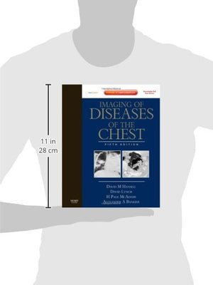Imaging Of Diseases Of The Chest: Expert Consult  Online And Print