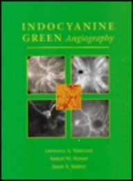 Indocyanine Green Angiography,Used