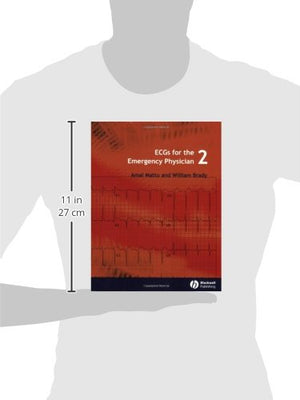 Ecgs For The Emergency Physician 2