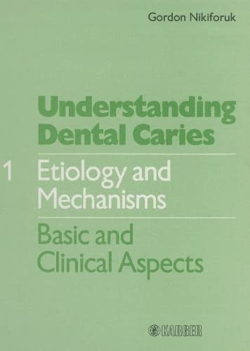 Understanding Dental Caries: Etiology and Mechanisms : Basic and Clinical Aspects,Used