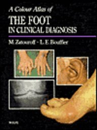 Color Atlas of Foot Conditions,Used