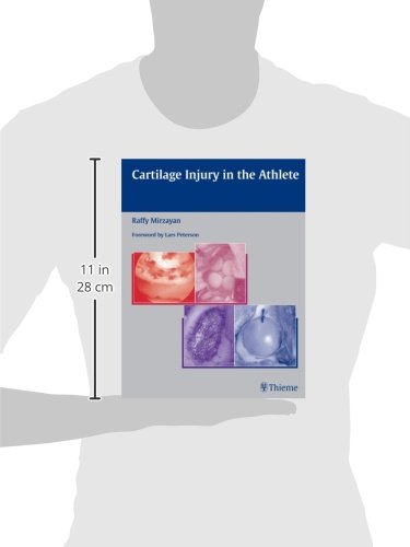 Cartilage Injury in the Athlete,Used