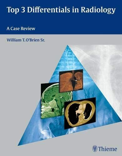 Top 3 Differentials in Radiology: A Case Review,Used
