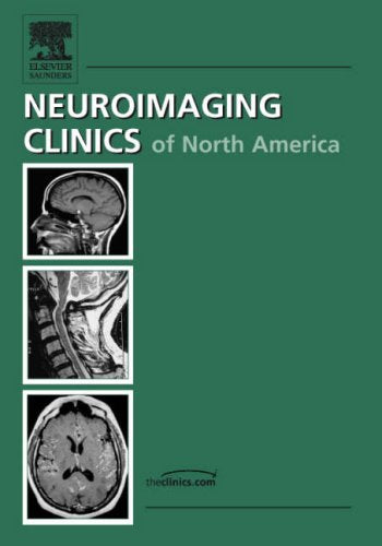 Advanced Pediatric Neuroimaging (Neuroimaging Clinics: Volume 16, Number 1, February 2006) (Volume 161),Used
