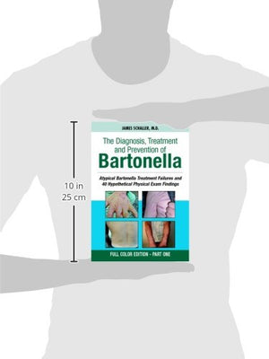 The Diagnosis, Treatment and Prevention of Bartonella: Atypical Bartonella Treatment Failures and 40 Hypothetical Physical Exam ,Used