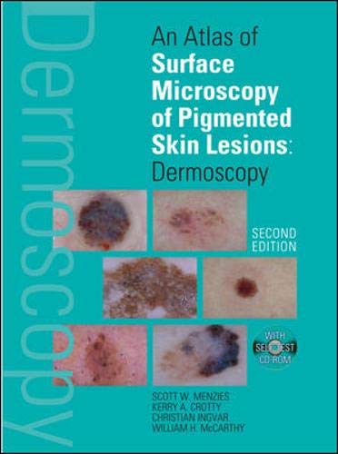 An Atlas of Surface Microscopy of Pigmented Skin Lesions: Dermoscopy, Second Edition,Used