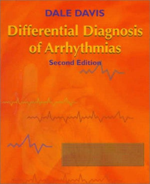 Differential Diagnosis Of Arrhythmias,New