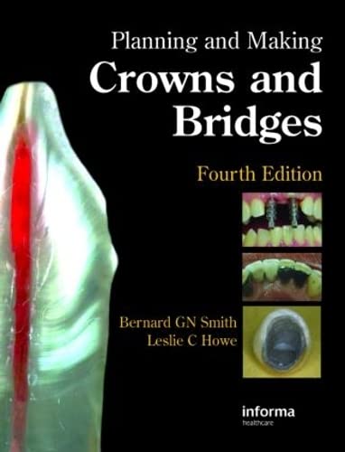 Planning And Making Crowns And Bridges,Used