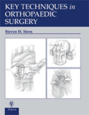 Key Techniques in Orthopaedic Surgery,Used