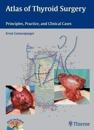 Atlas of Thyroid Surgery: Principles, Practice and Clinical Cases,Used