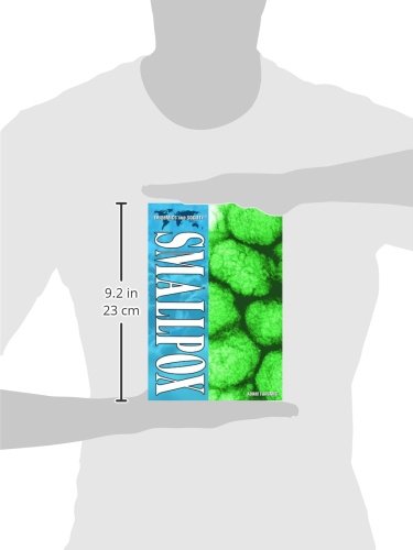 Smallpox (Epidemics and Society),Used