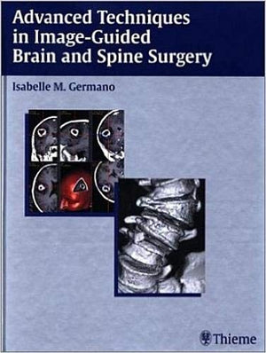 Advanced Techniques in ImageGuided Brain and Spine Surgery,New