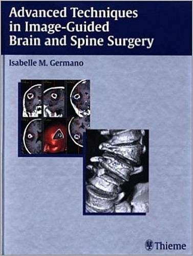 Advanced Techniques in ImageGuided Brain and Spine Surgery,Used
