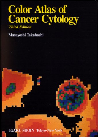 Color Atlas of Cancer Cytology,Used