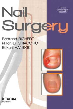 Nail Surgery (Series in Dermatological Treatment),Used