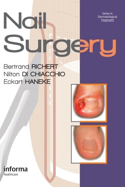 Nail Surgery (Series in Dermatological Treatment),Used