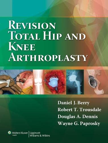Revision Total Hip and Knee Arthroplasty,Used