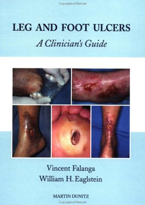 Leg and Foot Ulcers: A Clinician's Guide,Used