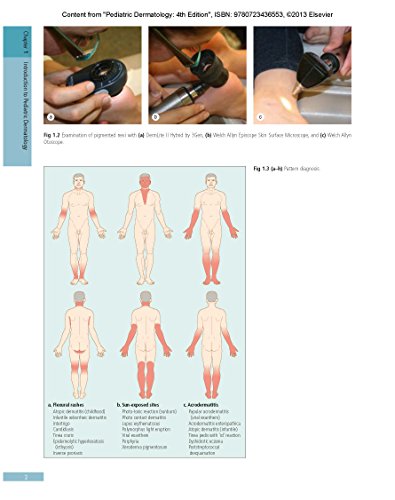Pediatric Dermatology: Expert Consult  Online and Print (Cohen, Pediatric Dermatology),Used
