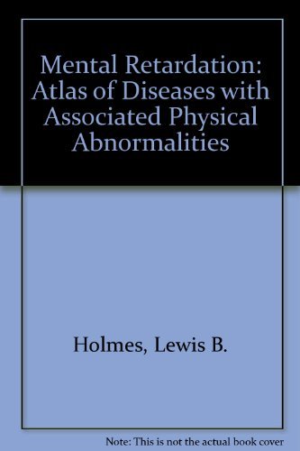 Mental Retardation: An Atlas of Diseases With Associated Physical Abnormalities,Used