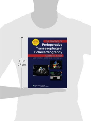 The Practice of Perioperative Transesophageal Echocardiography: Essential Cases,New
