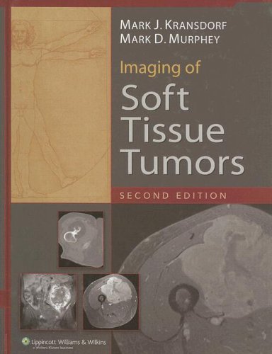 Imaging of Soft Tissue Tumors,Used