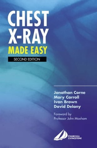 Chest XRay Made Easy,Used