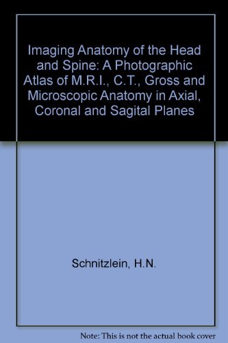 Imaging anatomy of the head and spine: A photographic color atlas of MRI, CT, gross, and microscopic anatomy in axial, coronal, ,Used