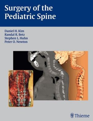 Surgery of the Pediatric Spine,Used