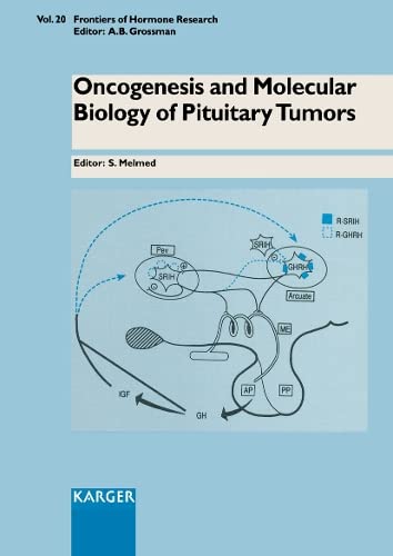 Oncogenesis and Molecular Biology of Pituitary Tumors (Frontiers of Hormone Research),Used