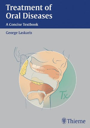 Treatment of Oral Diseases: A Concise Pocket Guide