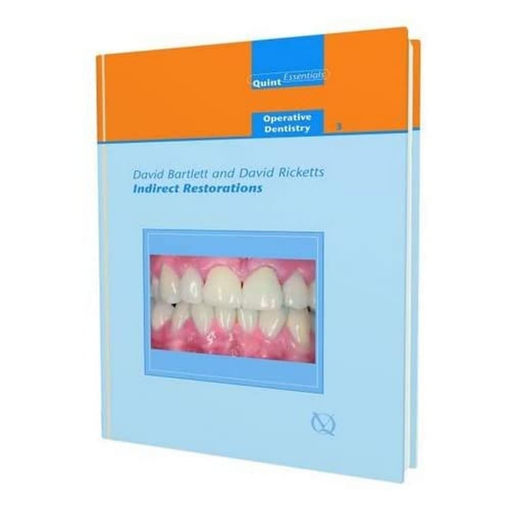 Indirect Restorations (Quintessentials of Dental Practice),Used