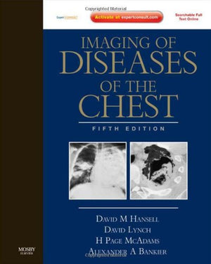 Imaging Of Diseases Of The Chest: Expert Consult  Online And Print