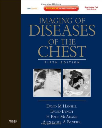 Imaging Of Diseases Of The Chest: Expert Consult  Online And Print