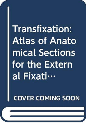 Transfixation: Atlas Anatomical Sections External Fixation Limbs,Used