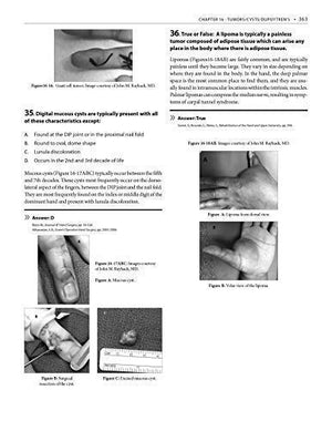 Hand and Upper Extremity Rehabilitation, 4th Ed Book  A Quick Reference Guide and Review,Used