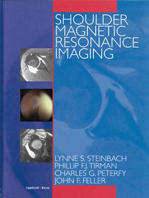 Shoulder Magnetic Resonance Imaging,Used