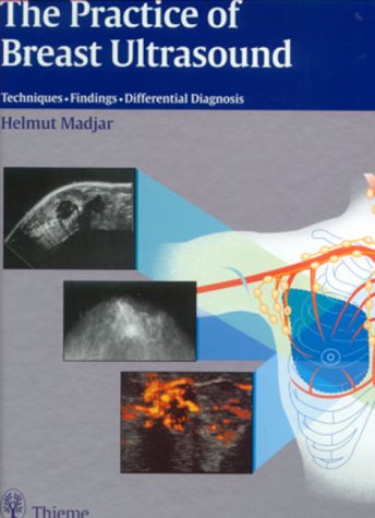The Practice Of Breast Ultrasound: Techniques, Findings, Differential Diagnosis