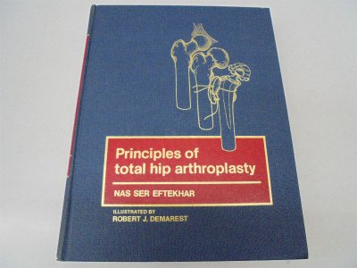 Principles of total hip arthroplasty,Used
